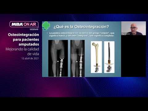 Encuentro virtual Osteointegración para Pacientes Amputados Mejorando la Calidad de Vida