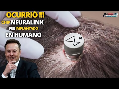 Elon Musk implantó su chip Neuralink en un humano | Optimus aparece al estilo Terminator